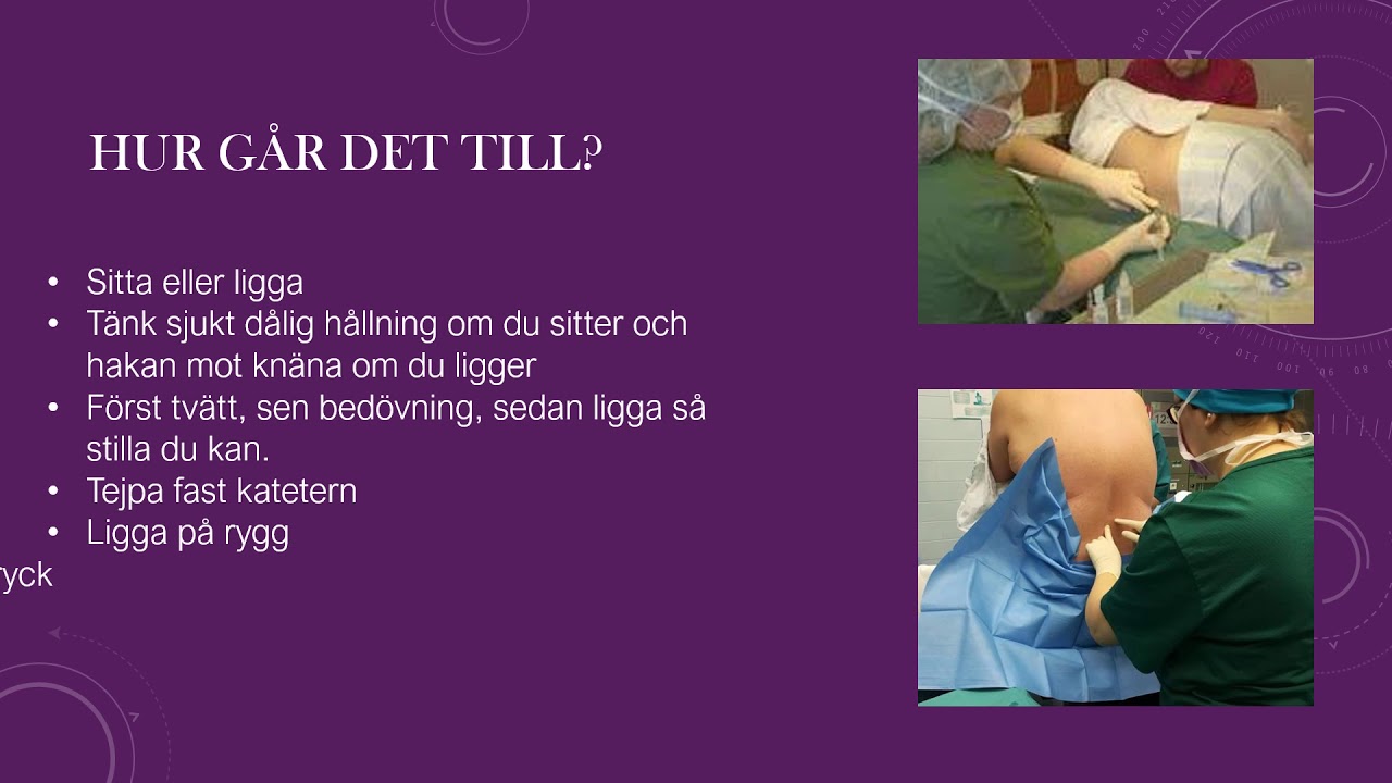 Ryggbedövning, vill jag ha det?