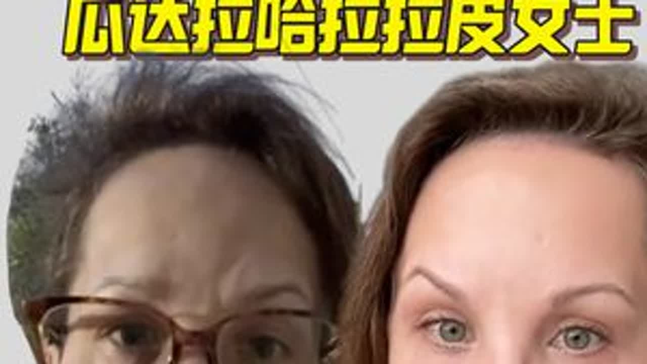 50岁墨西哥拉皮“换脸” 逆龄27岁惊呆外网 50岁女子做了拉皮手术，重返27岁青春。她的颜值逆袭故事此外网爆红，外网震惊：这做的太好了。#医美 #拉皮 #歪果仁系列