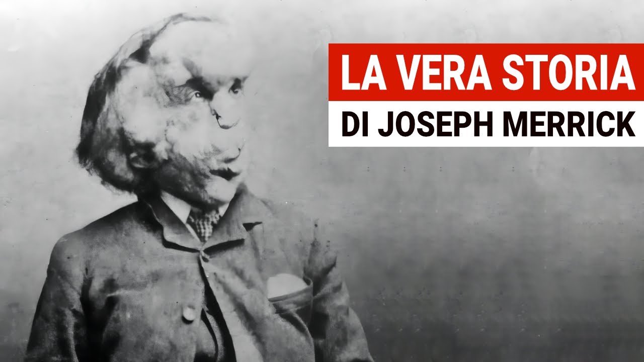 La VERA storia di Joseph Merrick