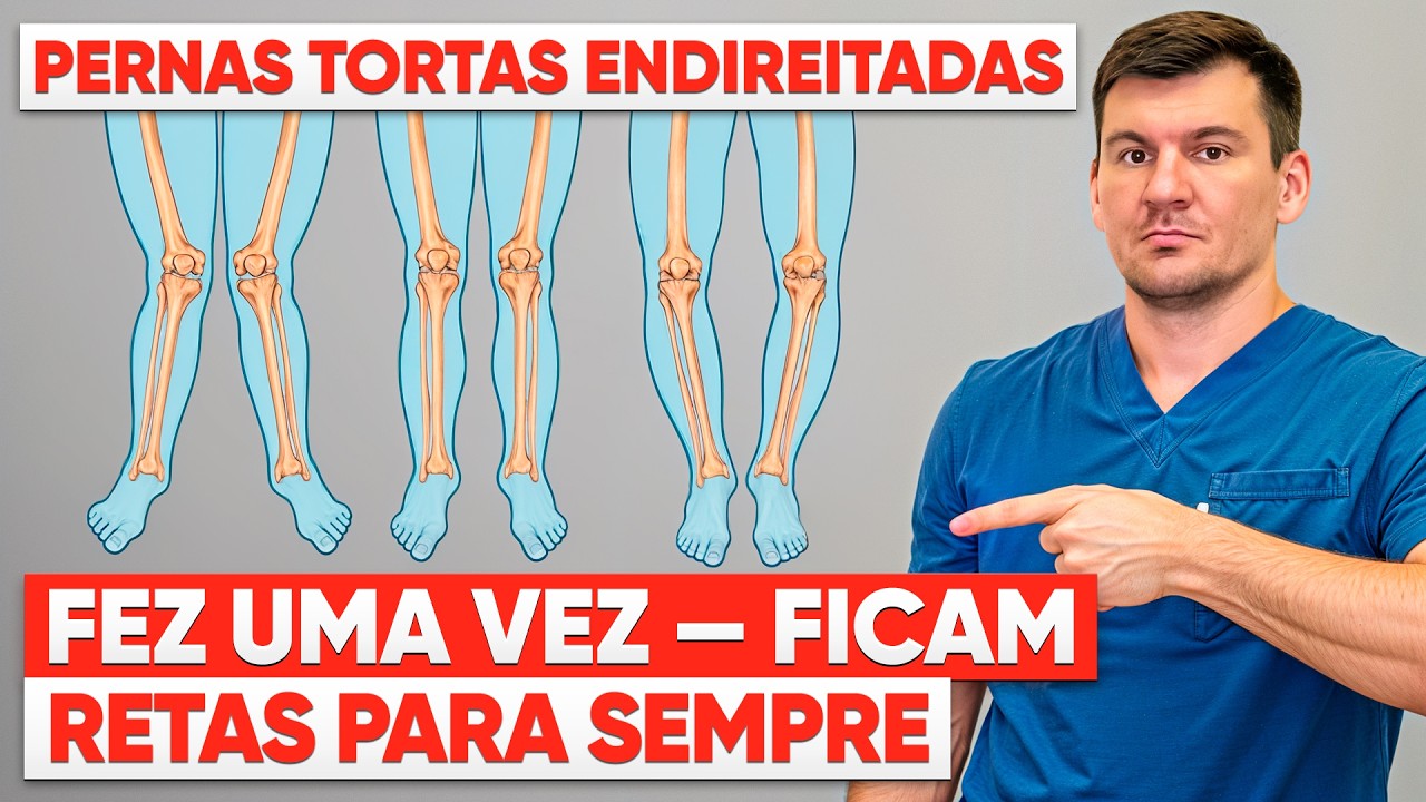 Pernas arqueadas ficam retas para sempre — sem cirurgiaFaça uma vez e veja a diferença! 💪