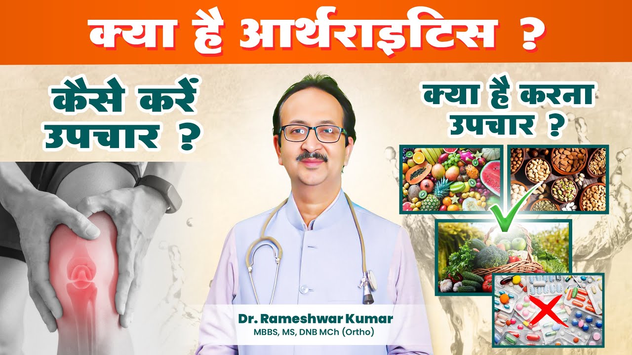 #Osteoarthritis क्या होता है | Knee Osteoarthritis के कारण, लक्षण और इलाज | Osteoarthritis Treatment