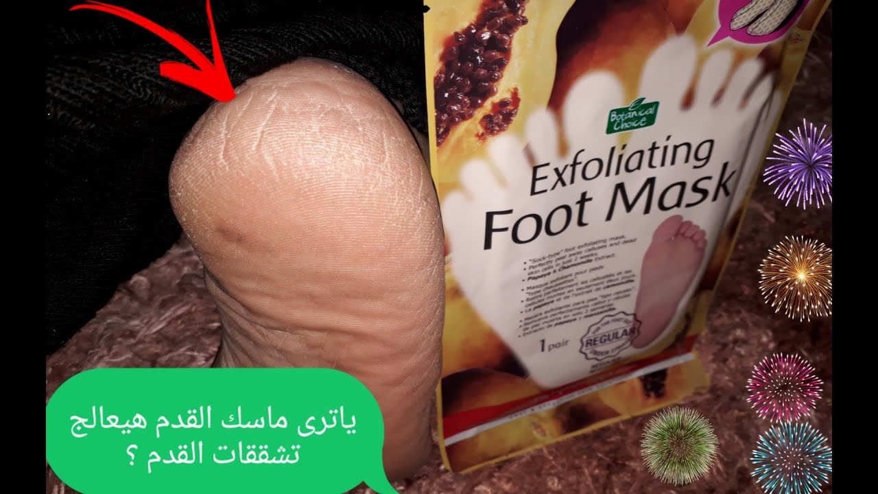 تجربة ماسك القدم الكورى فى علاج تشققات القدم 🤗🤗🤗