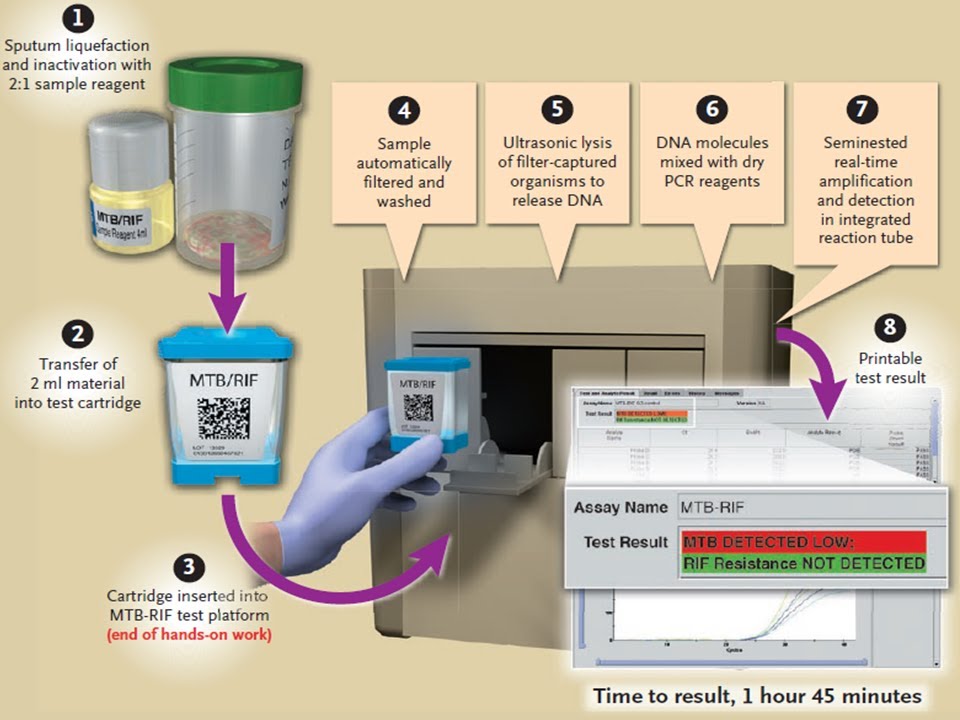An Overview of TB Laboratory Strengthening