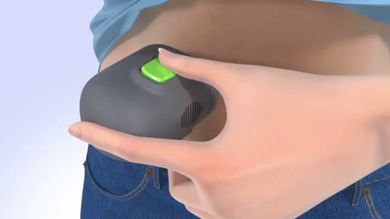 One-press Serter - simplifying sensor insertion
