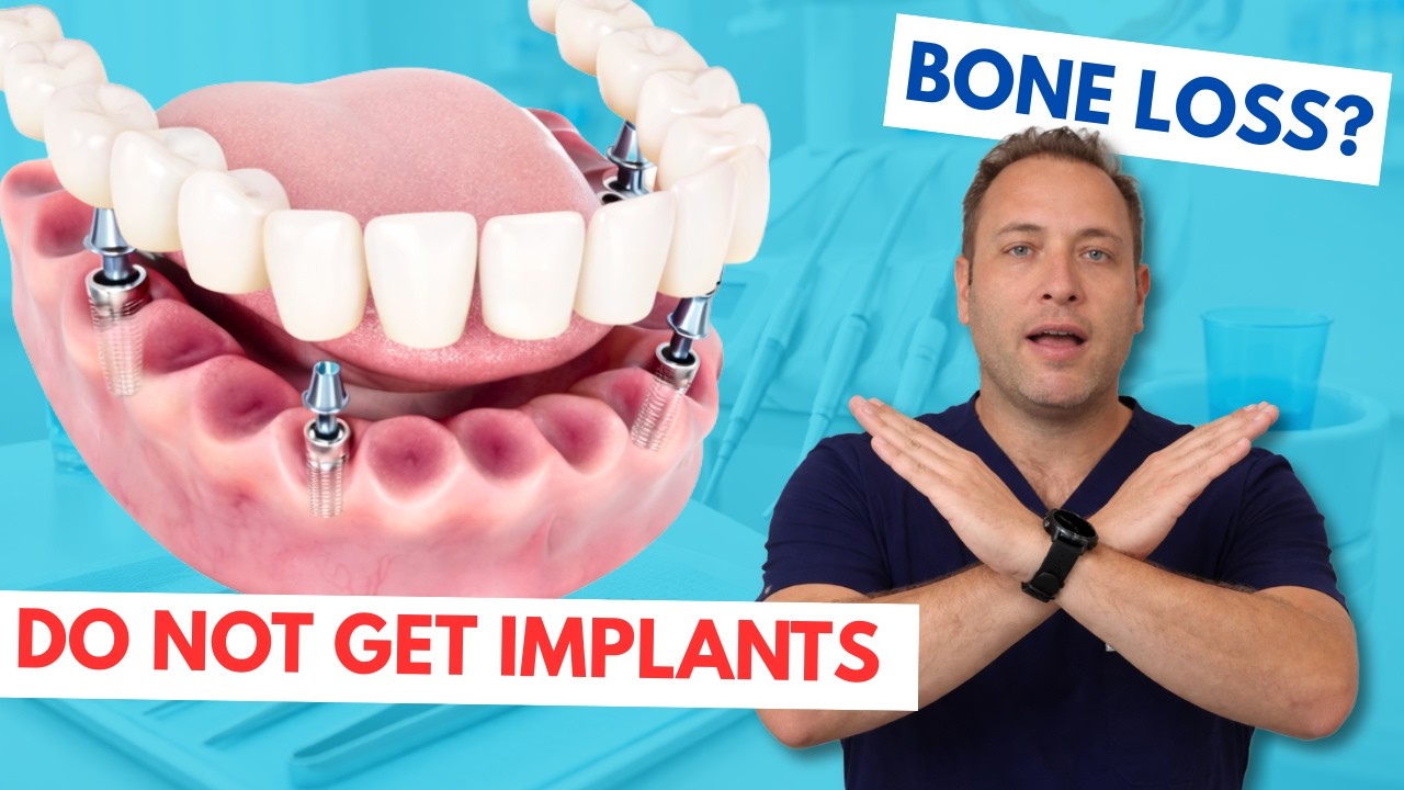 (What They Don’t Tell You) Teeth in a Day vs Traditional Dental Implants