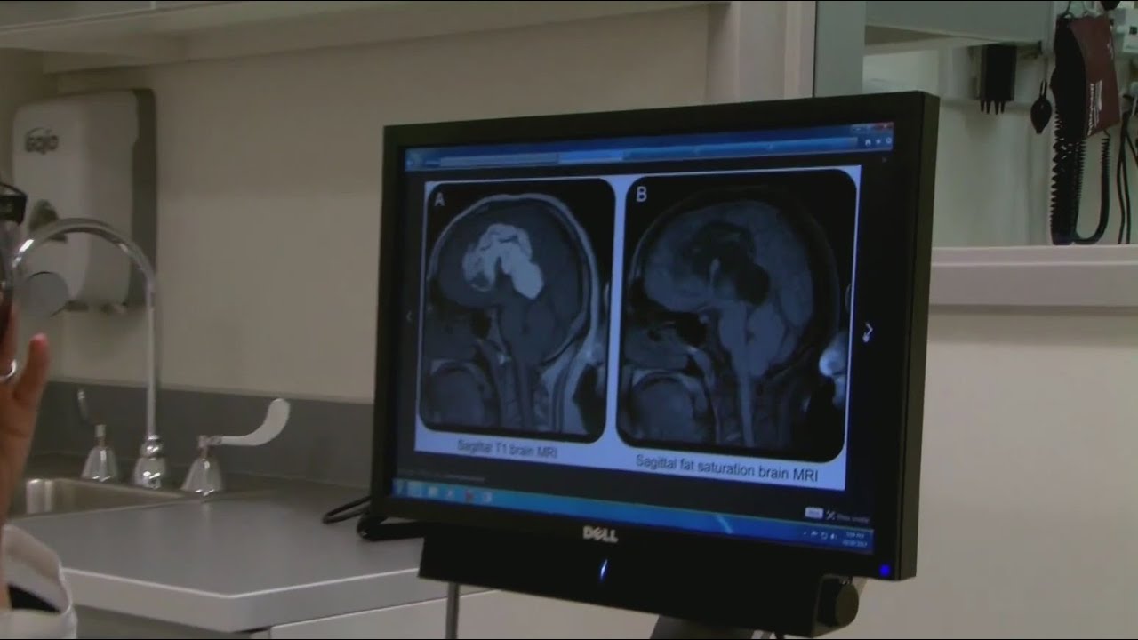 Pitt study finds when kids are treated immediately for concussions, their recovery is quicker