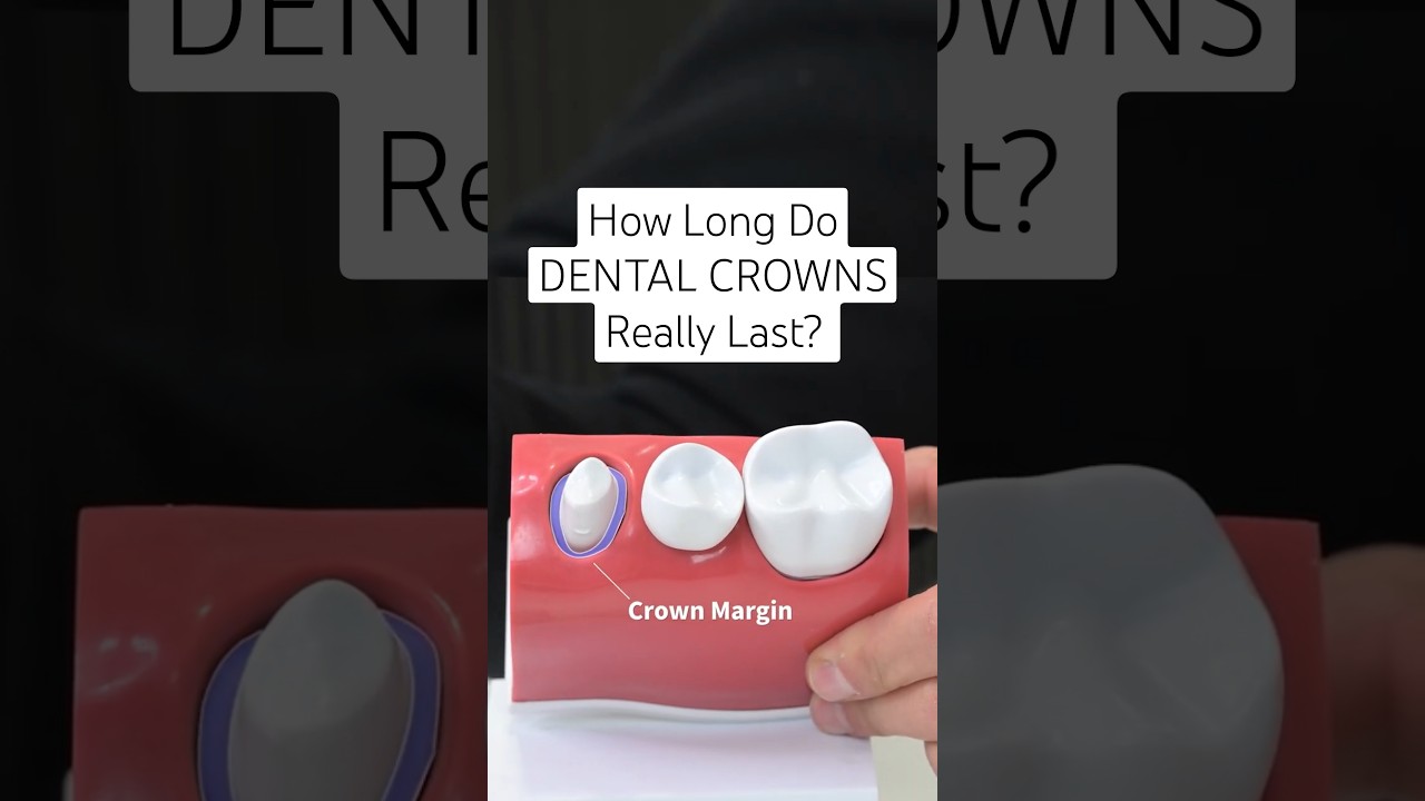 How Long Do Dental Crowns Really Last? #dentalcrowns