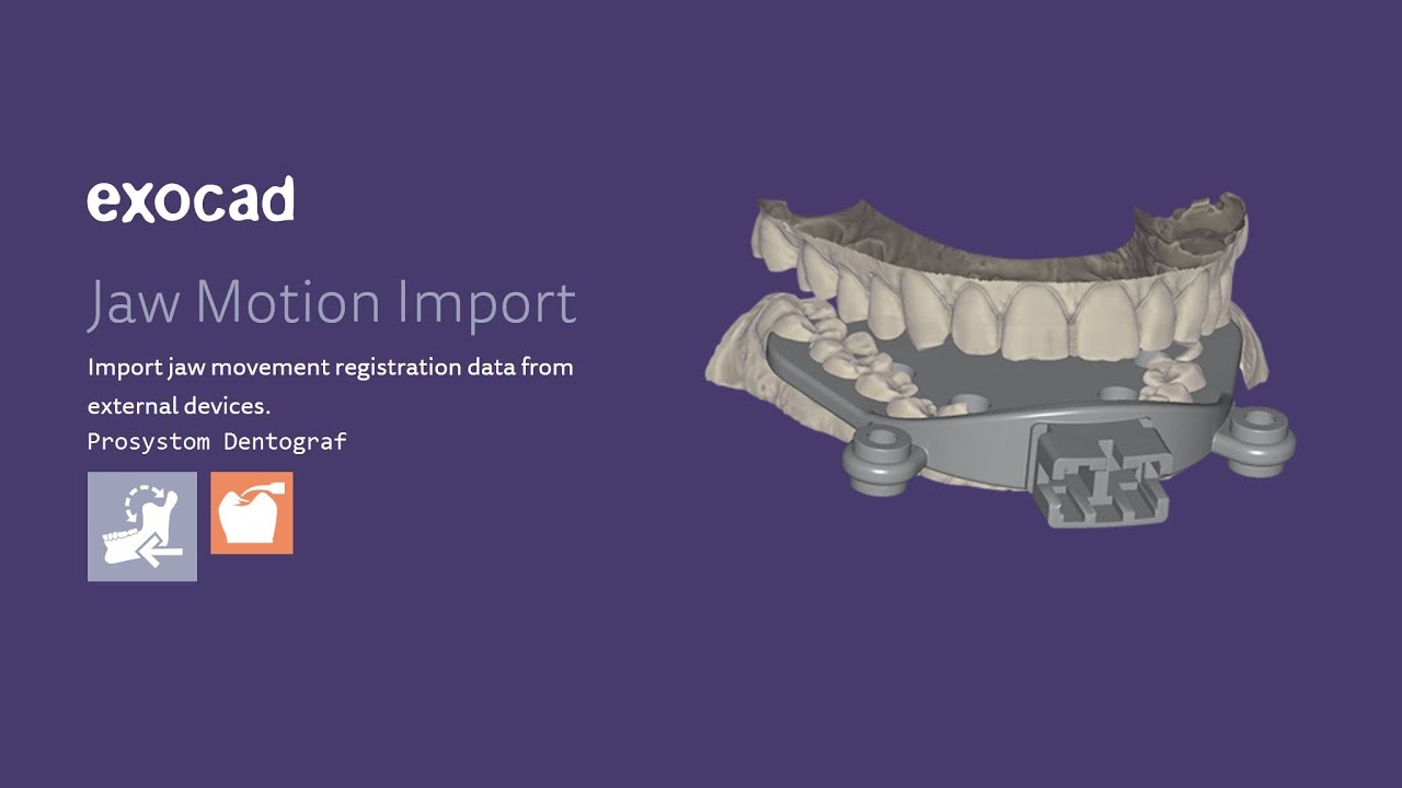 Exocad VALLETTA 2.2 Jaw Motion Import