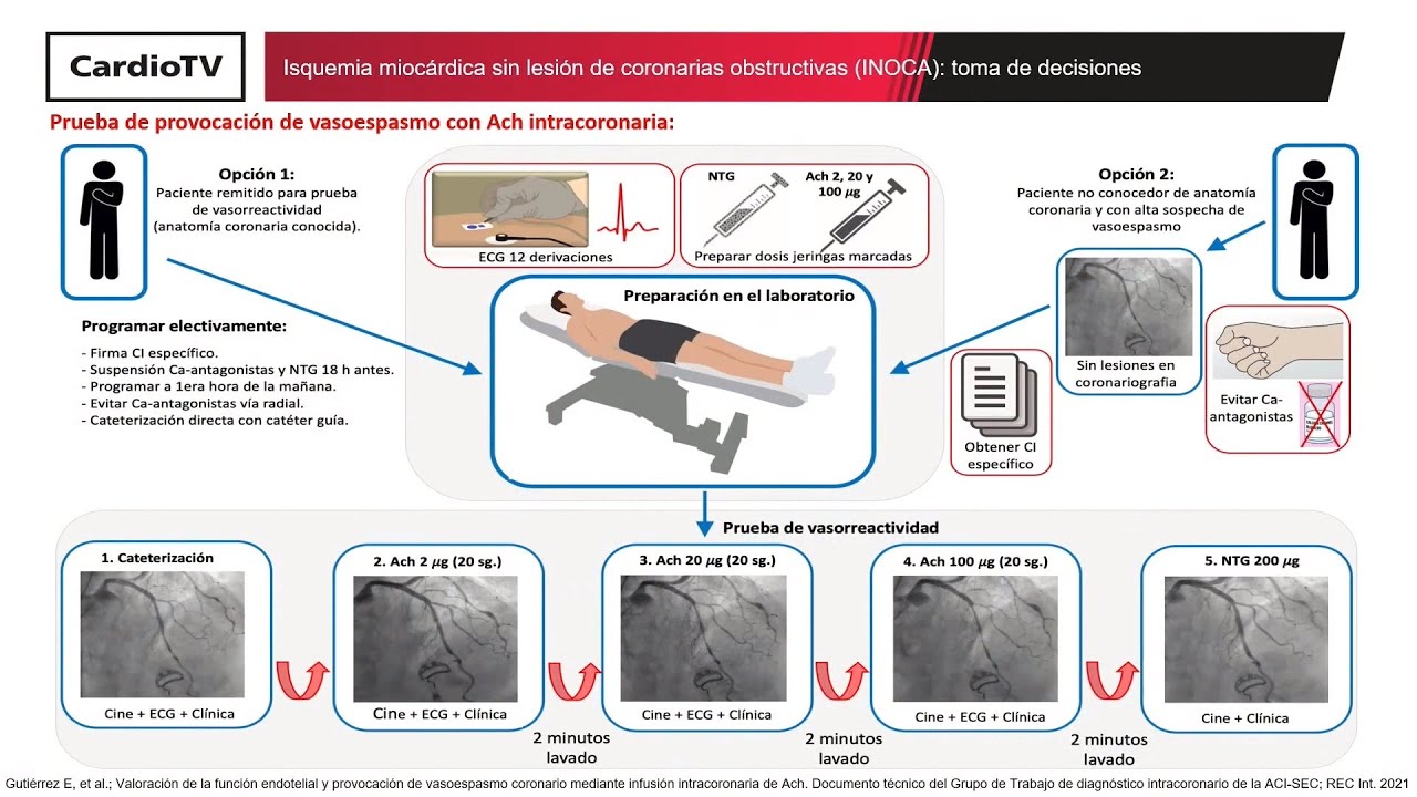 Isquemia miocárdica sin lesión de coronarias obstructivas (INOCA): toma de decisiones