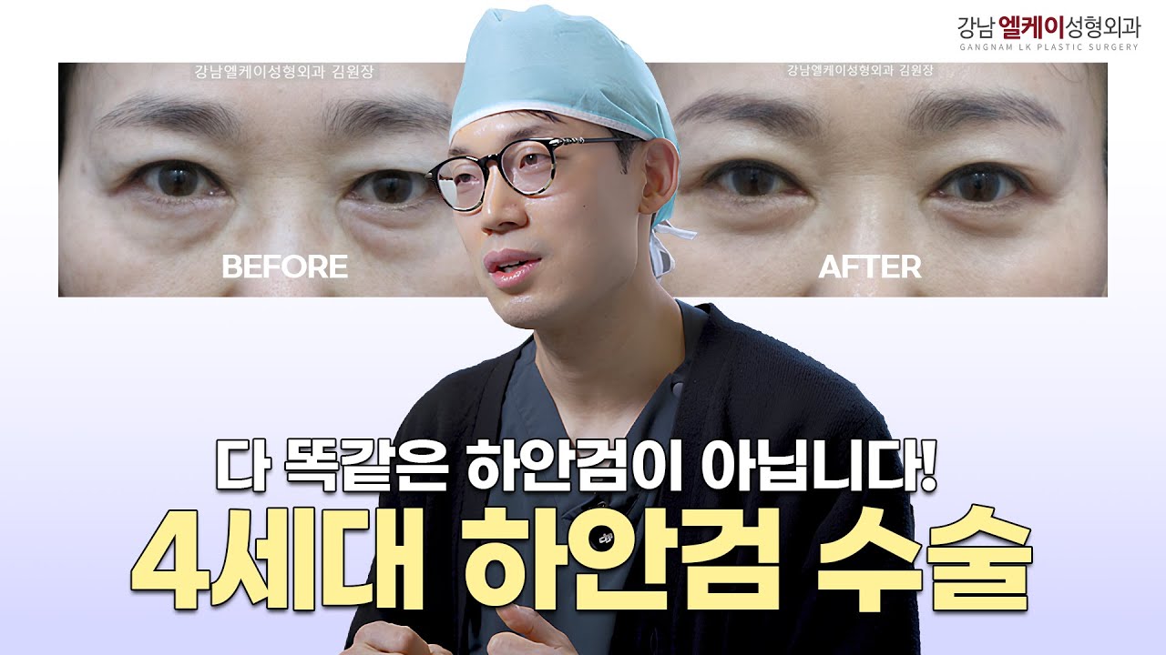 하안검수술!! 애굣살의 중요성!!✨4세대 리프팅하안검  어떤 차이가 있을까요?✨필수시청 🔍