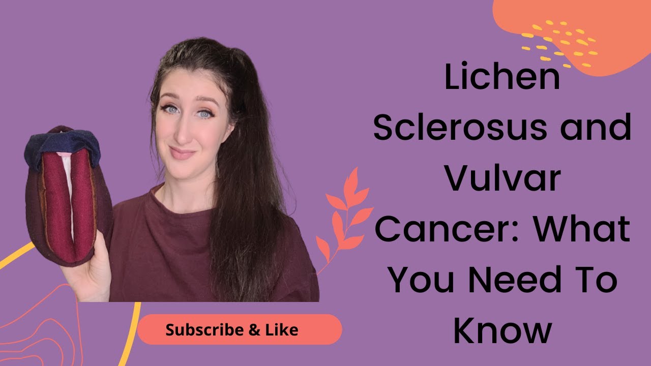 Lichen Sclerosus and Vulvar Cancer: What You Need To Know