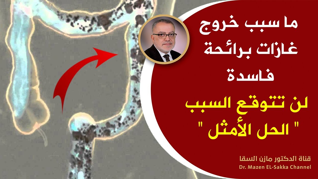 هل تعلم ماهو سبب خروج غازات برائحة كريهة علاج غازات البطن بطرق طبيعية وتنظيف الجسم من البراز المتحجر