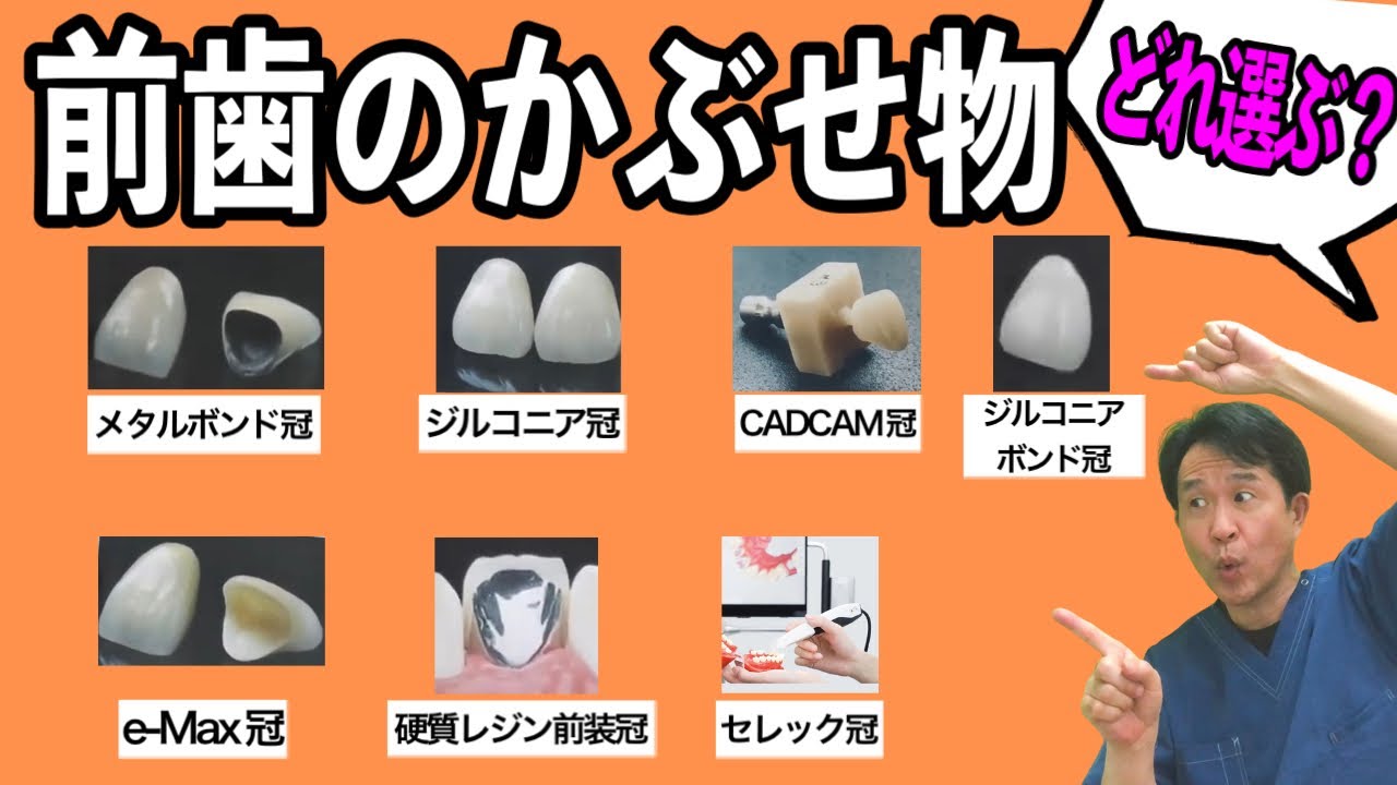【前歯のかぶせ物７選】長持ちする歯、美しい歯はどれ？　おすすめ治療法を歯医者が解説