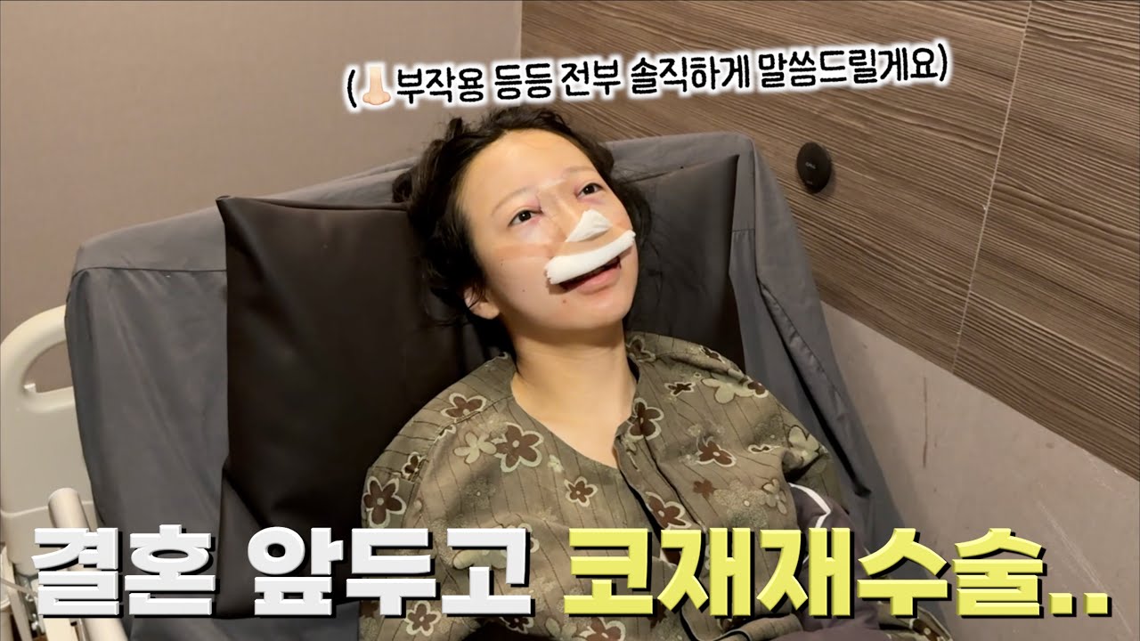 결혼 앞두고 수술하고 왔어요..👃🏻부작용 등등 솔직하게 말씀드릴게요