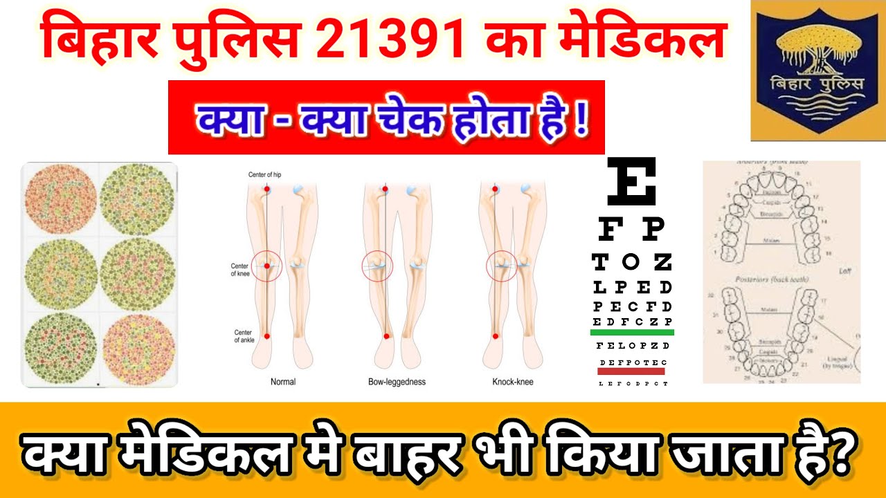 Bihar Police Ka Medical Kaise Hota Hai | Bihar Police Medical Test Full Details | Bihar Police