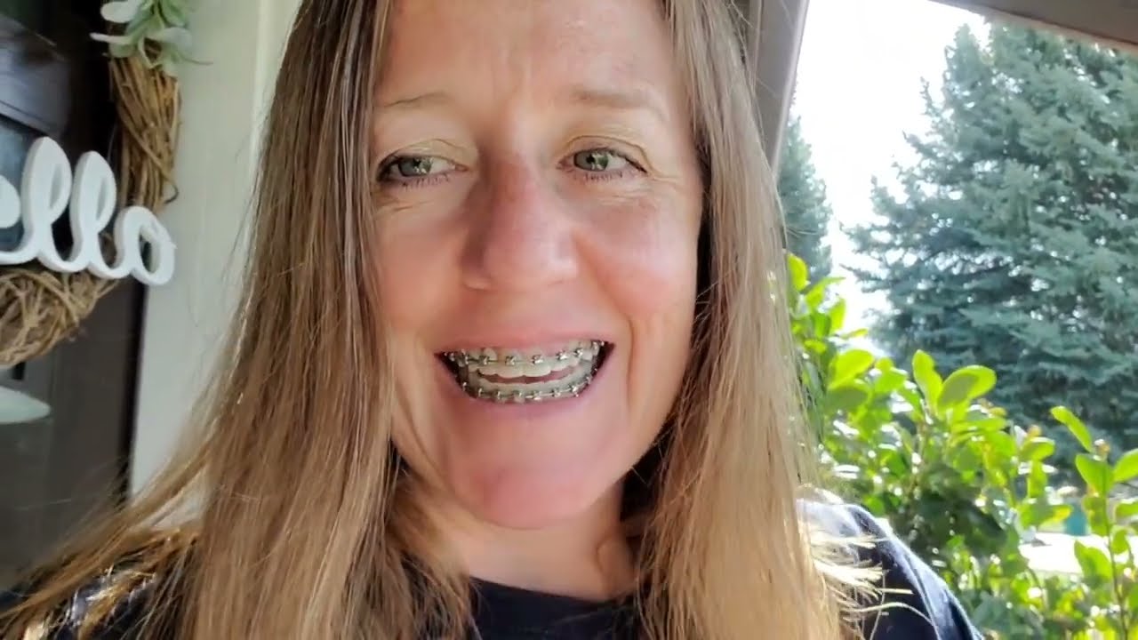 Getting my adult braces removed