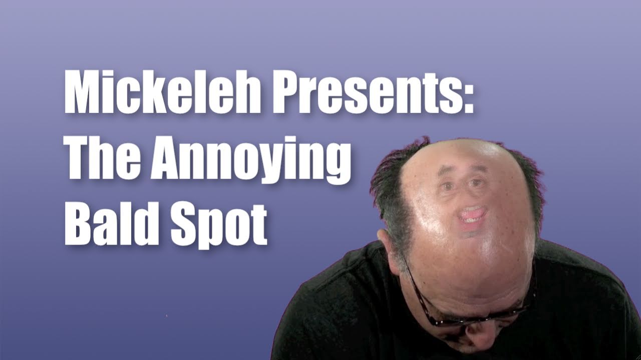 Mickeleh Presents: The Annoying Bald Spot