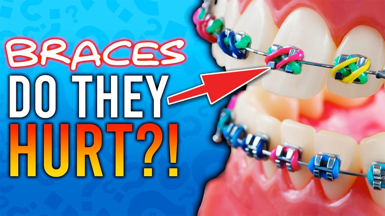 Do Braces Hurt?