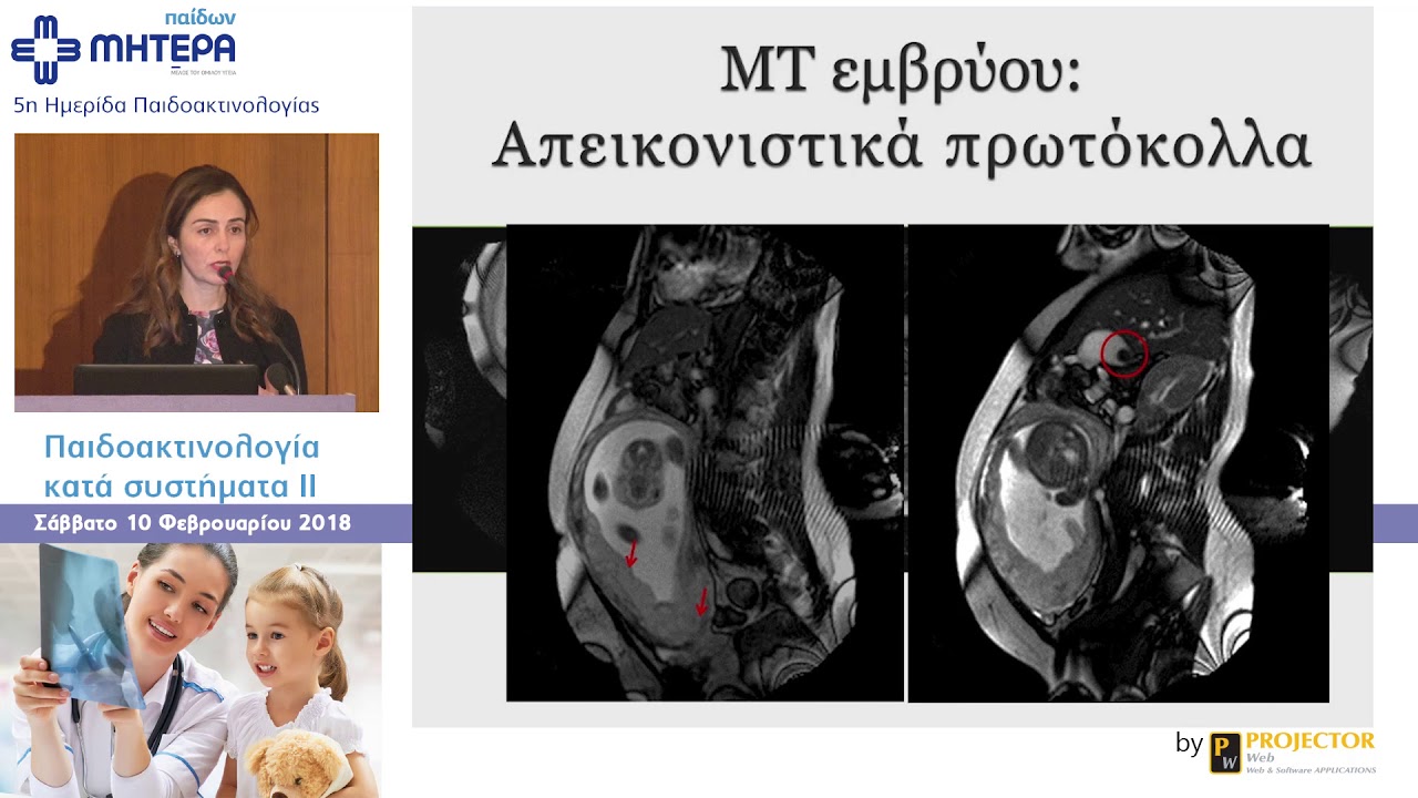 10 Χρόνια Μαγνητικής Τομογραφίας Εμβρύου στο ΜΗΤΕΡΑ - Γ. Παπαϊωάννου