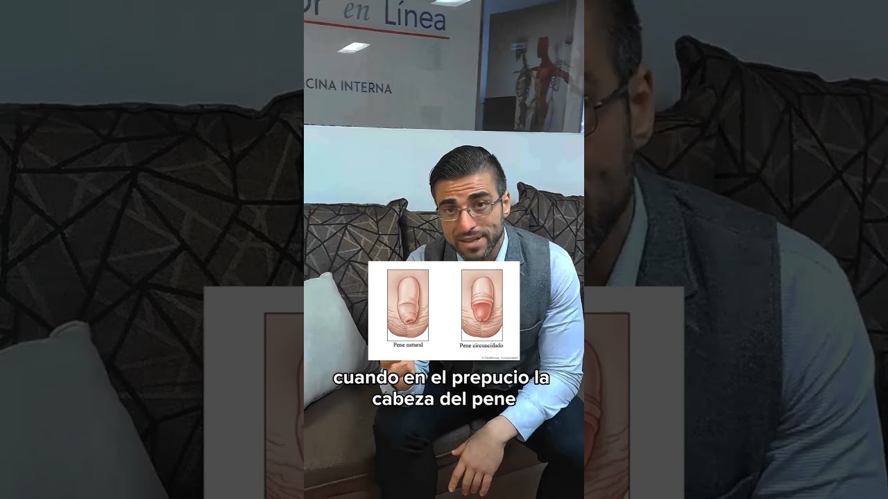 &iquest;Cu&aacute;l es la indicaci&oacute;n para realizarse la Circuncisi&oacute;n? Te dejo la respuesta en el video.