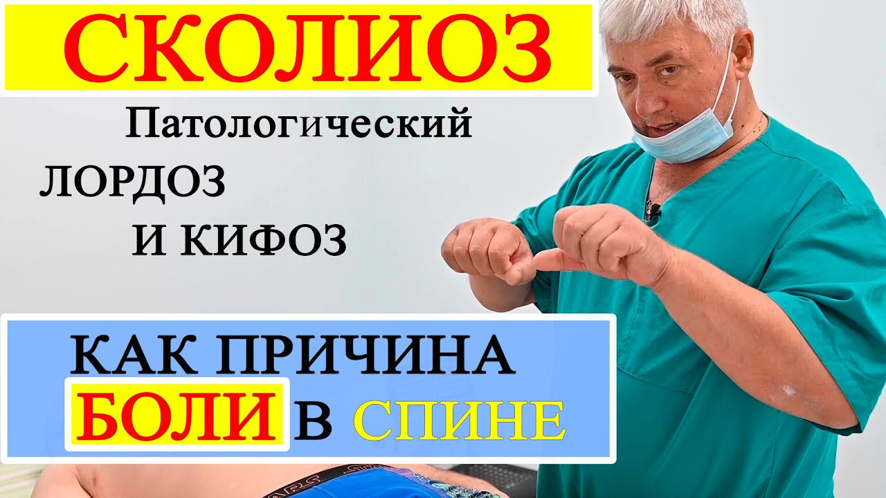СКОЛИОЗ. Патологические Лордозы и Кифозы как причина БОЛИ в СПИНЕ. Как ЛЕЧИТЬ?