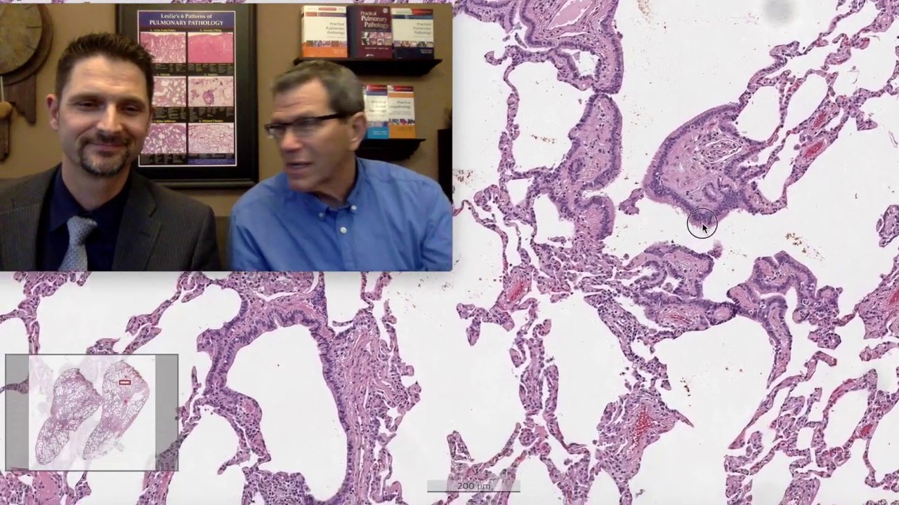Pattern 3 - Cellular Infiltrates, Hypersensitivity (Top 25 Pearls Series, Topic 4, Pearl 2)