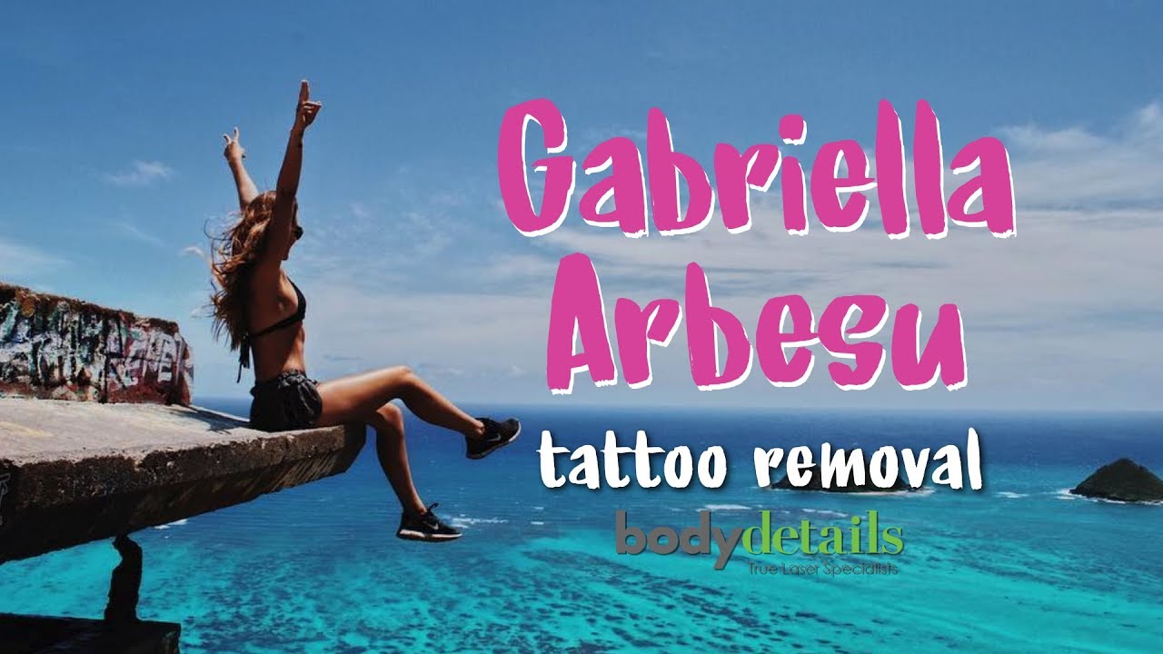 Laser Tattoo Removal Progress | Gabriella Arbesu | Body Details