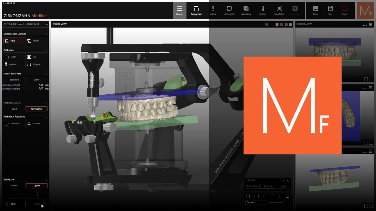 Plaster-free articulation: how to use the JawAligner in Zirkonzahn.Modifier | Zirkonzahn.Software