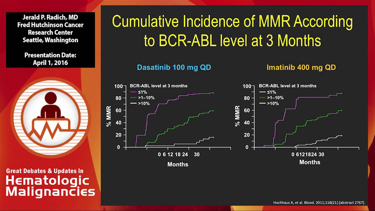 When can TKIs be stopped in CML?