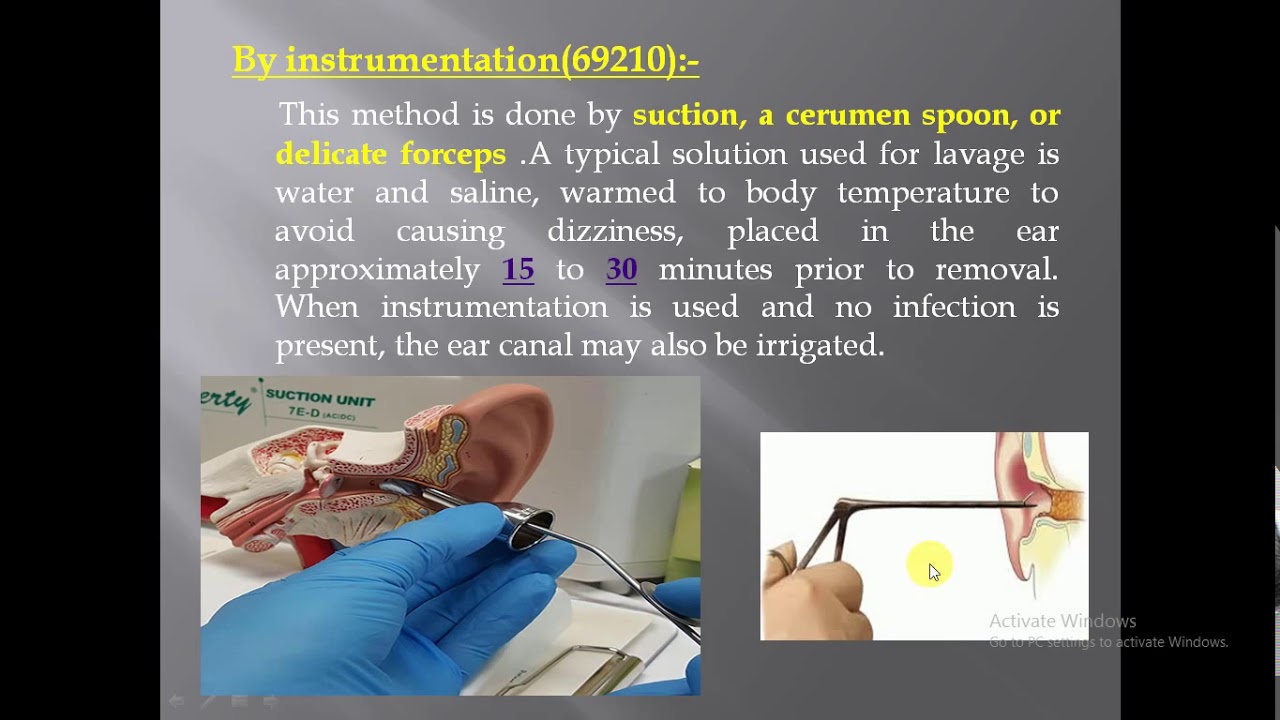Medical Coding | Impacted Cerumen Removal Coding in ED|  Emergency Department