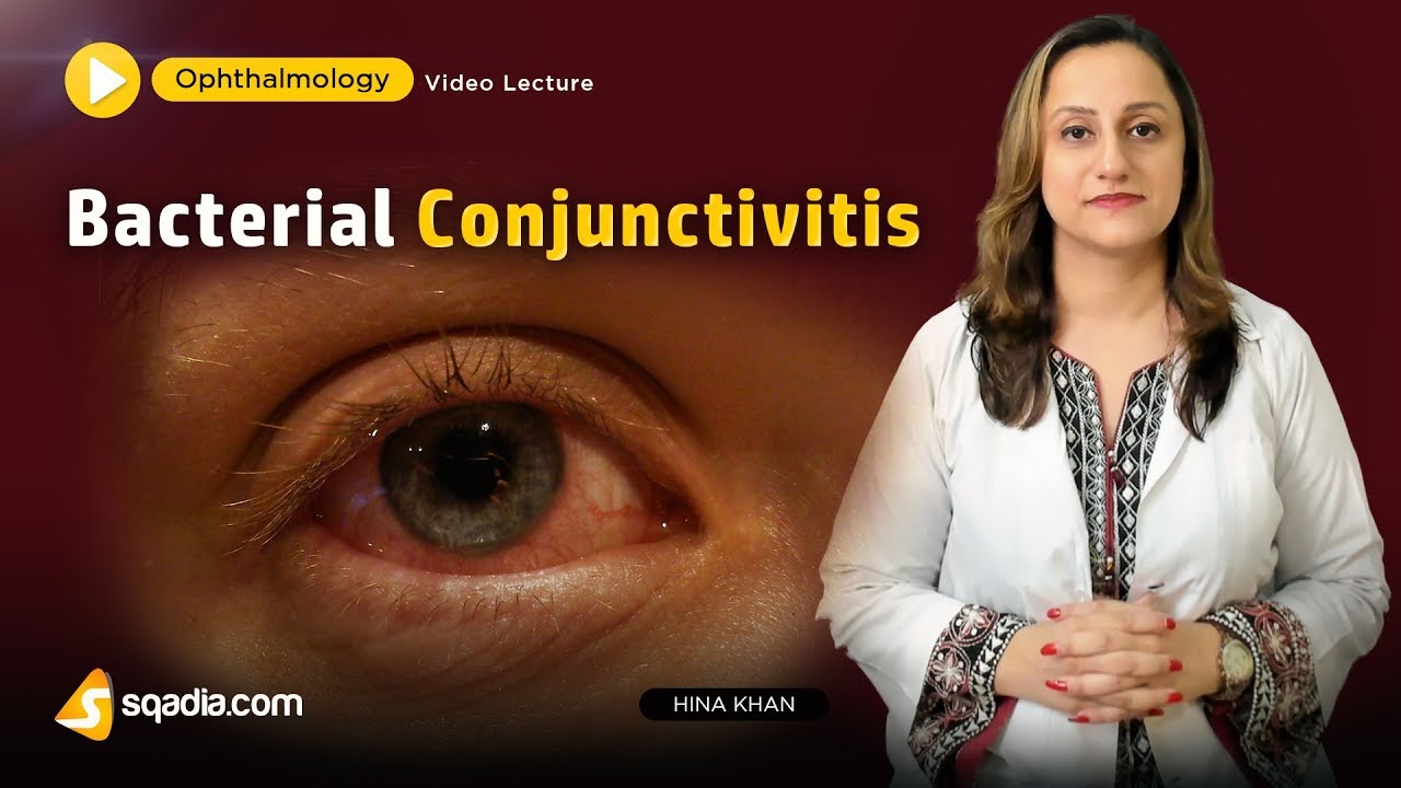 Bacterial Conjunctivitis | Ophthalmology Video Lecture