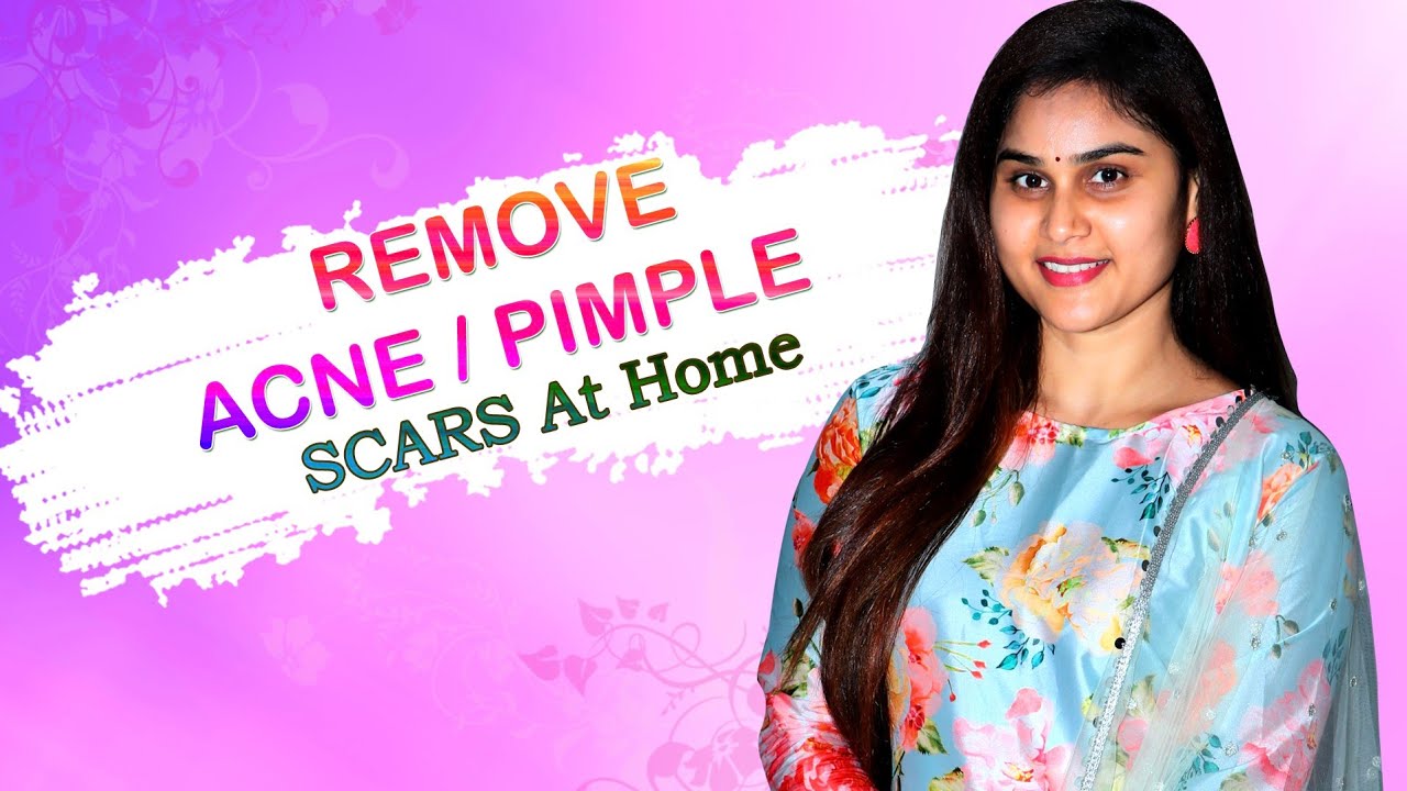 Best way to remove pimples, acne & acne scars