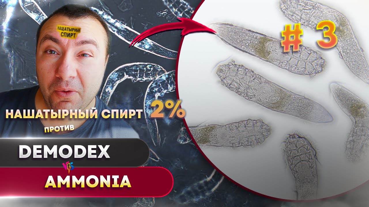 Убьёт ли нашатырь 2% клеща Демодекс? Эксперимент под микроскопом #3