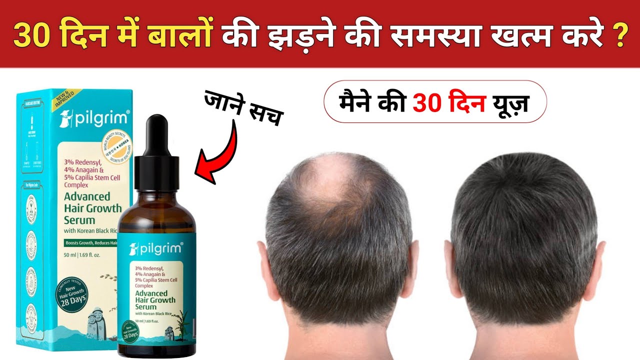Pligirm advance hair growth serum | pligirm advance hair growth serum review | pligirm hair serum 