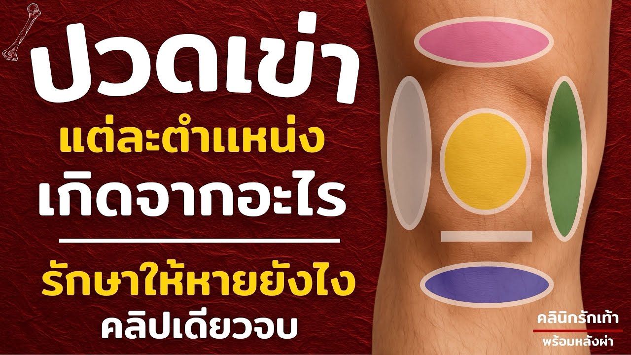 ปวดเข่าแต่ละจุด รักษาอย่างไร อธิบายแบบง่าย คลิปเดียวจบ