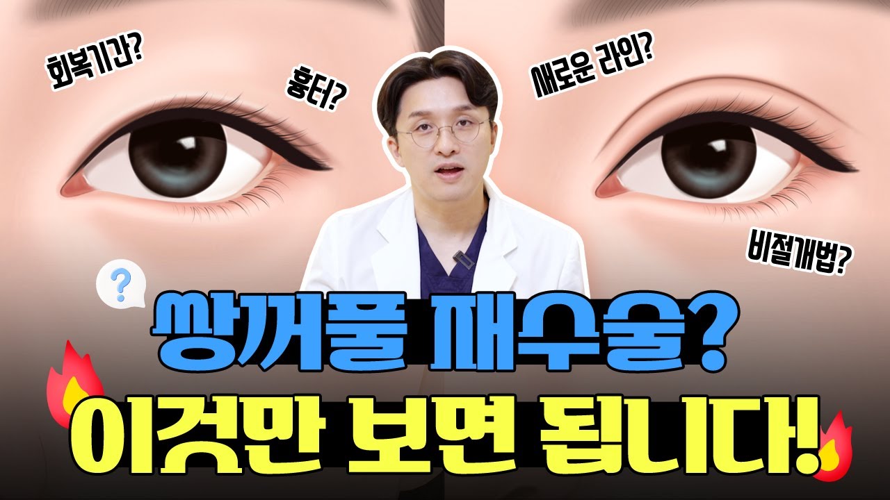 #쌍꺼풀재수술 이것만 보면 됩니다❗| #성형외과전문의 #성형외과의사