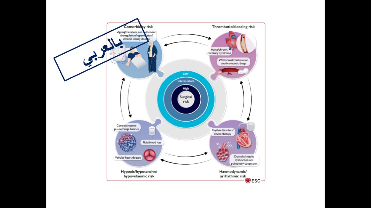 ESC Guidelines: 1. Preoperative Consultation (Arabic Version)