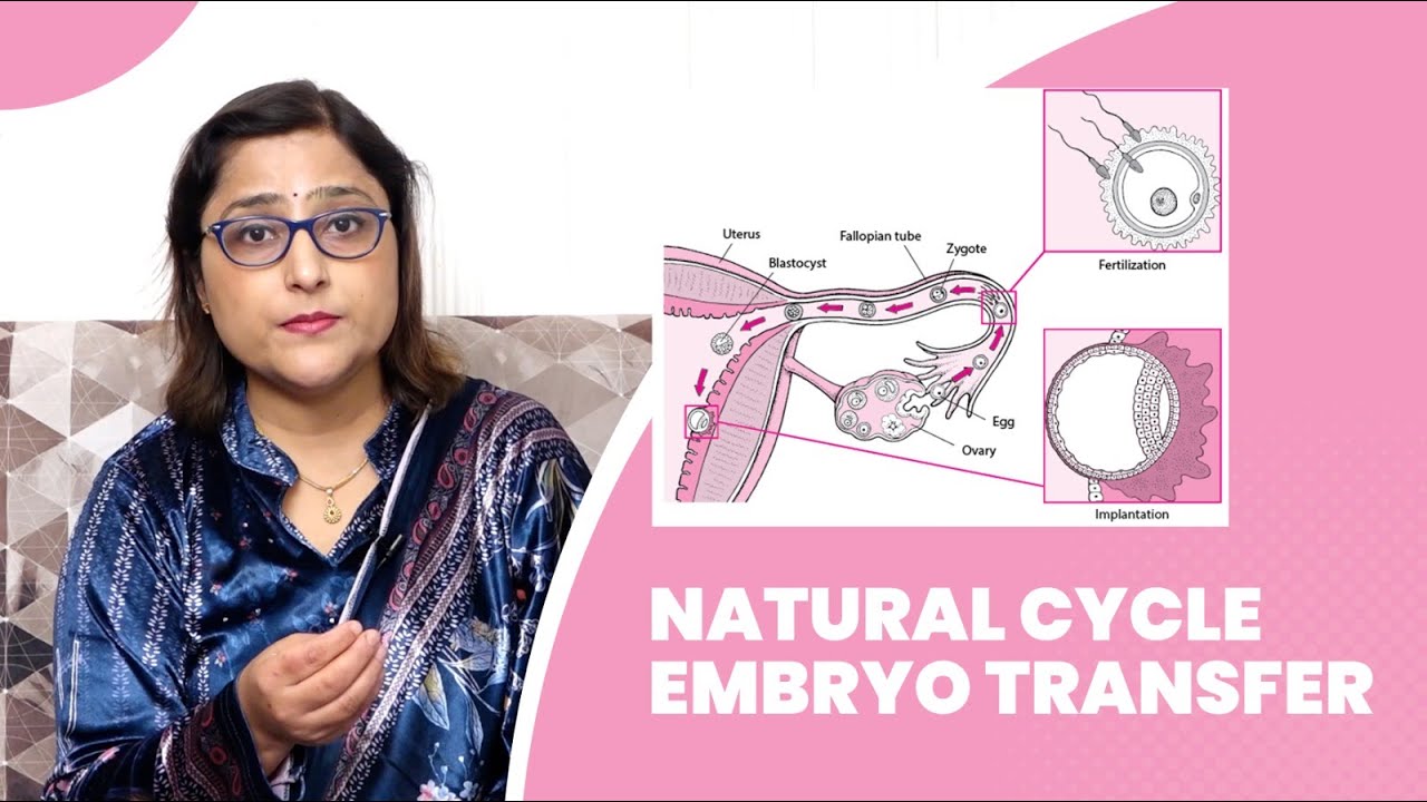 natural cycle embryo transfer in IVF