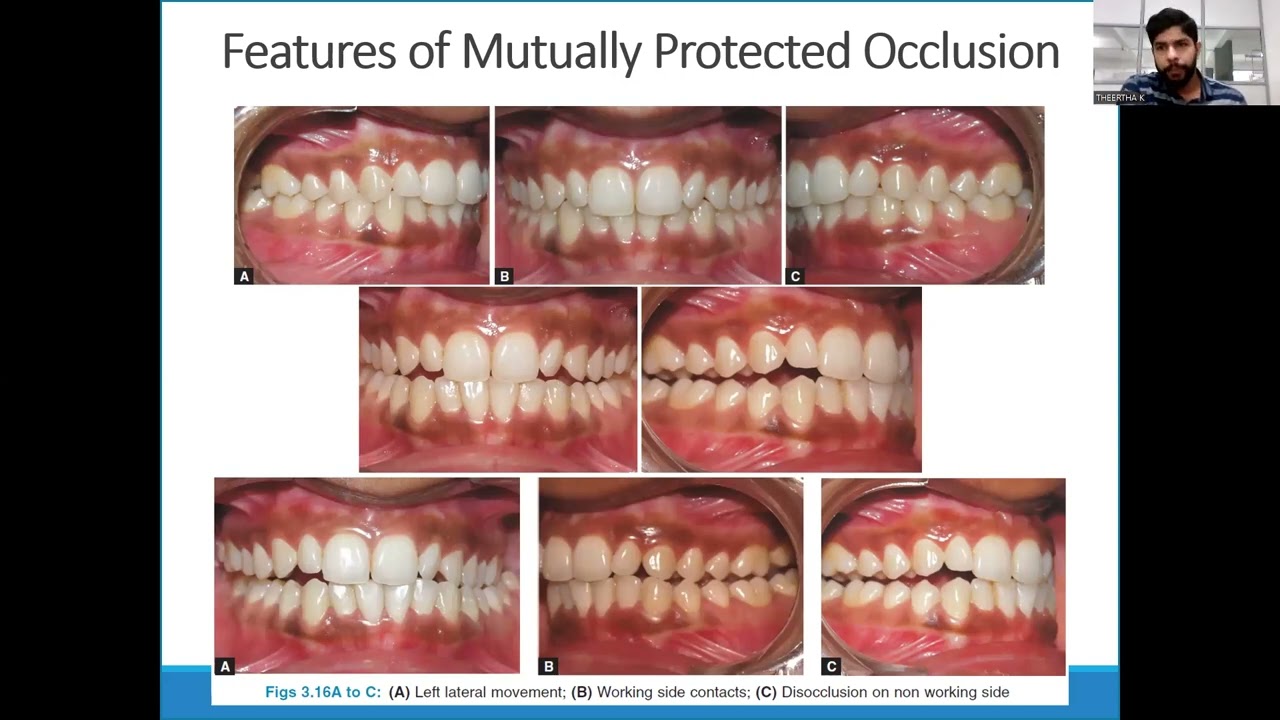 OCCLUSION | Dr ASHISH | DEPARTMENT OF CONSERVATIVE DENTISTRY AND ENDODONTICS |
