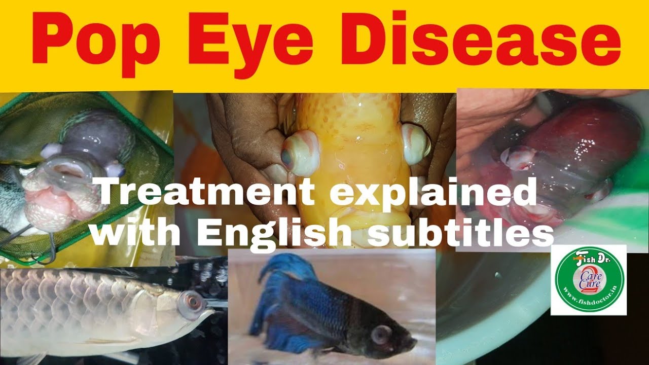 pop eye disease - medicines & treatments