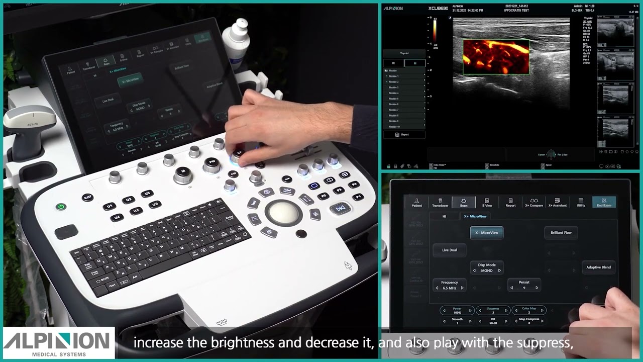 X-CUBE 90 Tutorial: COLOR DOPPLER