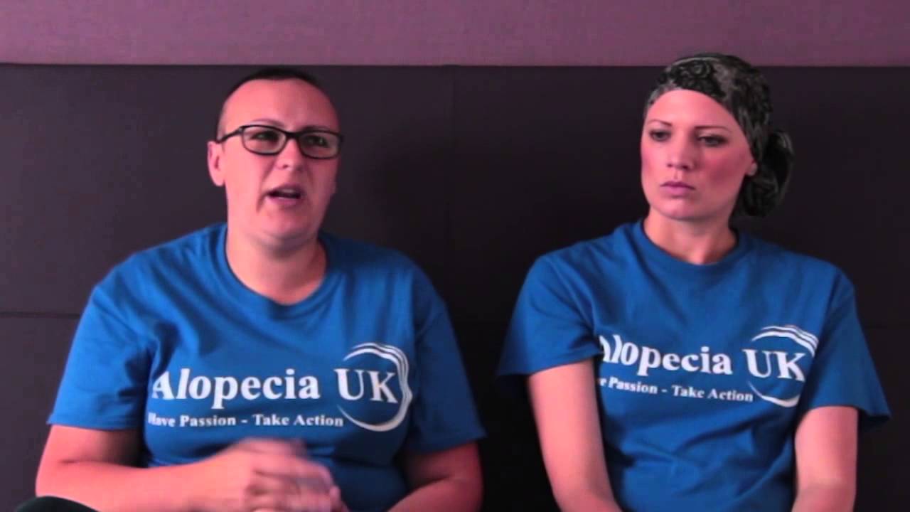 Dealing with Alopecia in the workplace