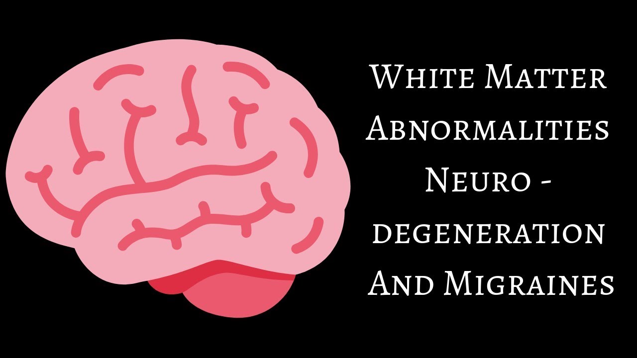 White Matter Abnormalities, Neurodegeneration And Migraines
