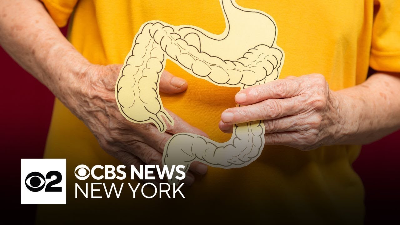Doctors see rise in colorectal cancer in middle-aged people