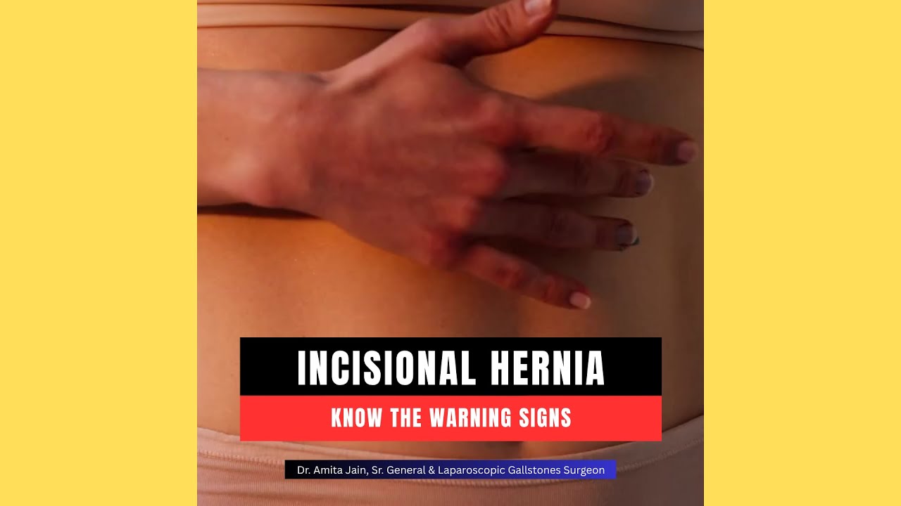 Incisional Hernia Symptoms & Treatments by Top Surgeon Dr. Amita Jain