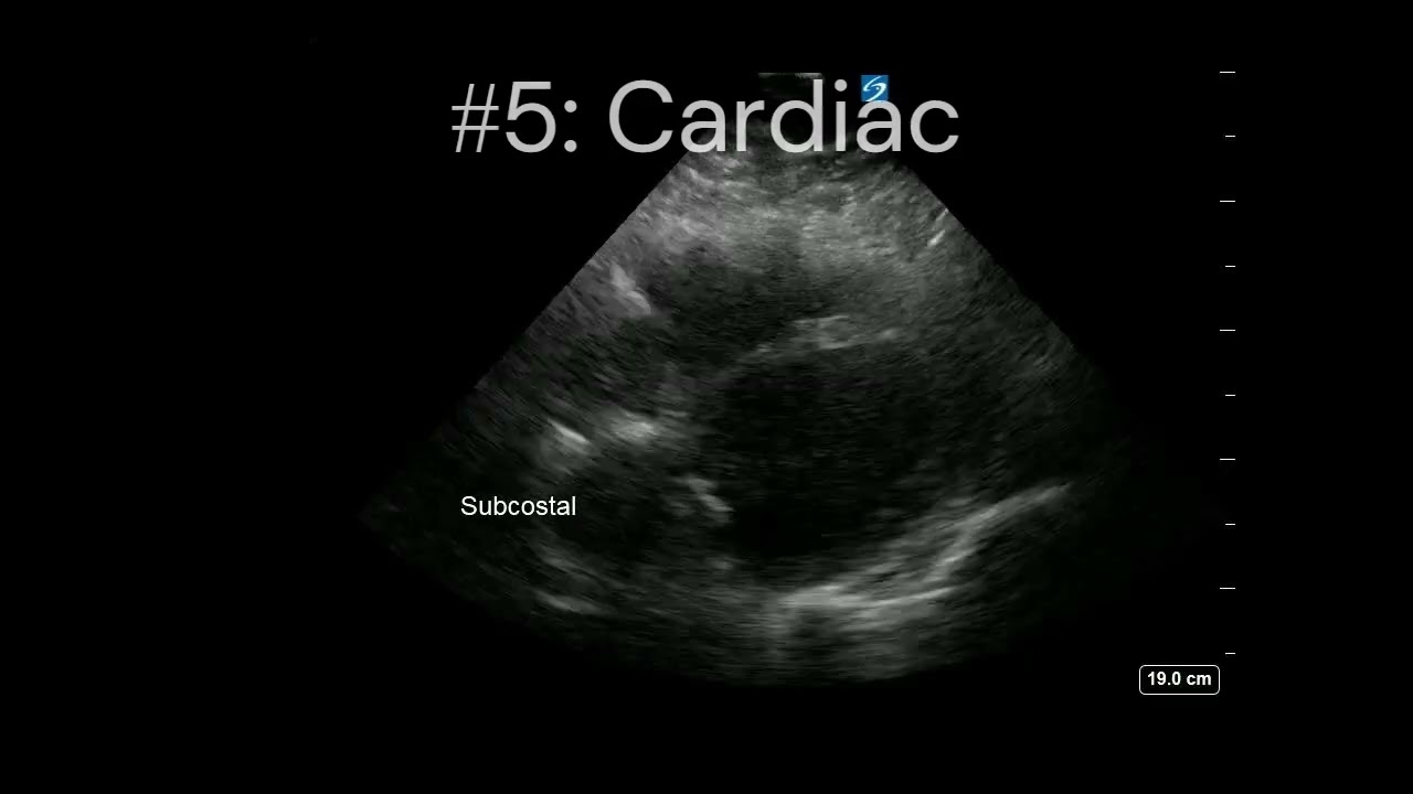 Top 10 Reasons to POCUS in Primary Care | Butterfly Network
