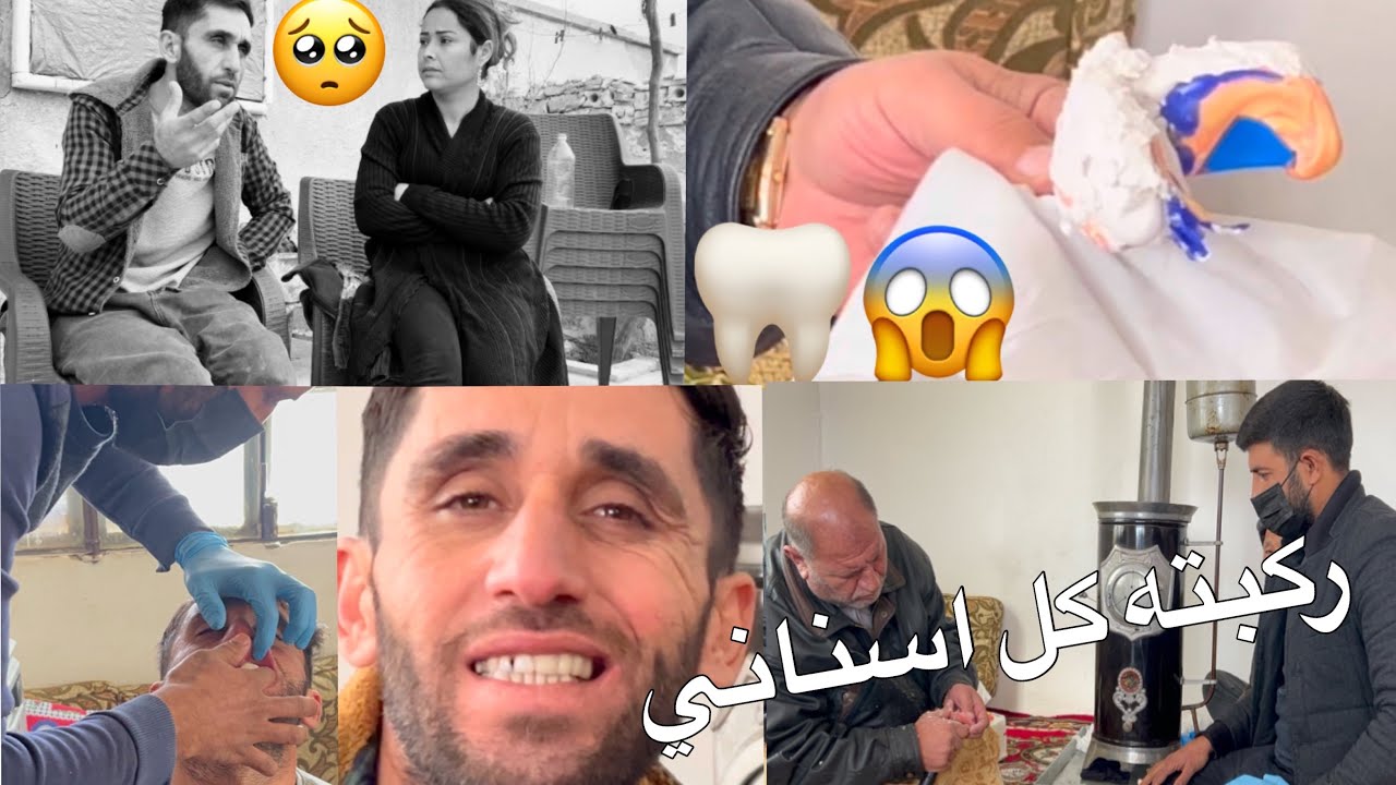  اليوم الاول عمري 😰ركبت طقم اسنان اعطينا رايكم اصعب شيء اسنان🦷🤓😱