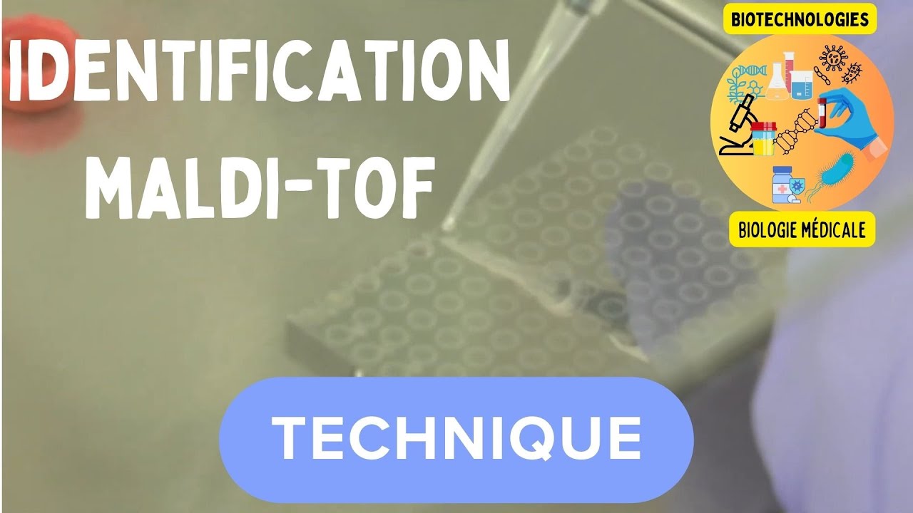 Spectromètre de masse au service de l'identification au laboratoire d'analyses médicale. MALDI-TOF.