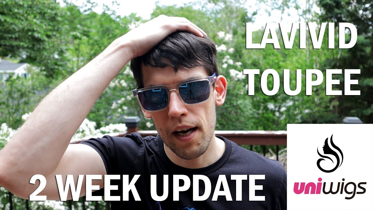 LIVING WITH A TOUPEE - 2 WEEK UPDATE