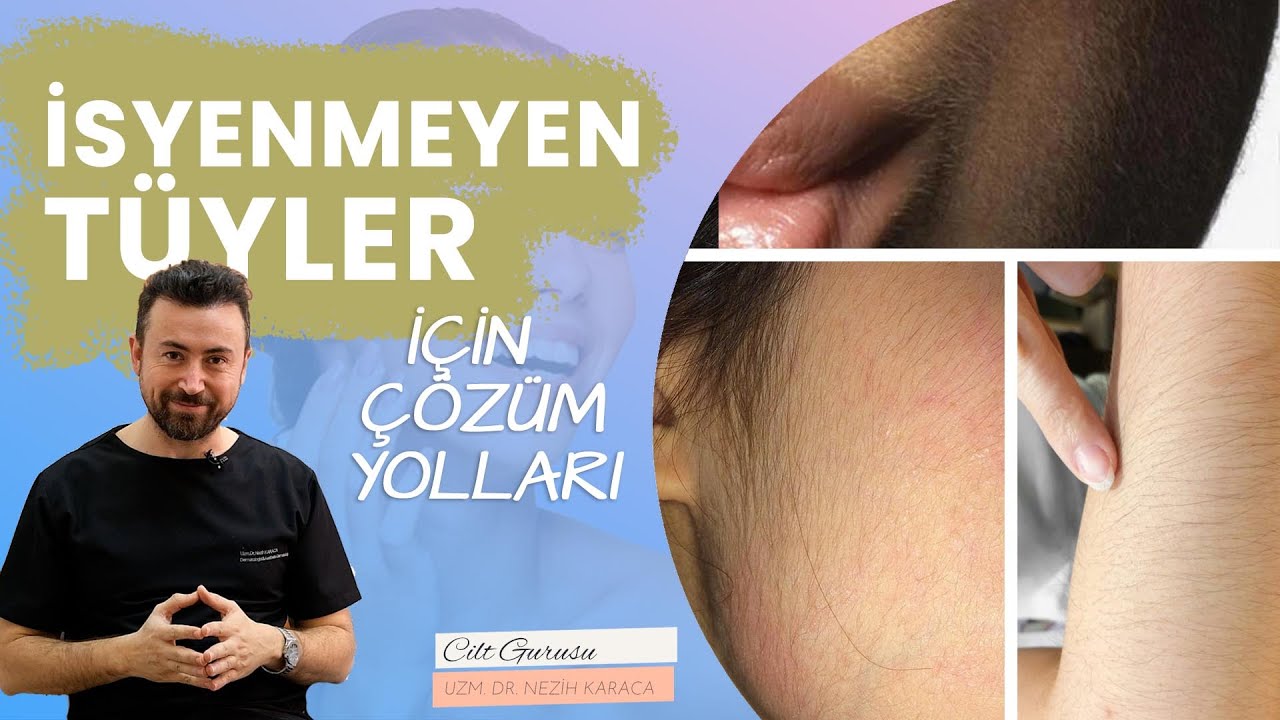 Vücuttaki İstenmeyen Tüylerden Kurtulmak? Çözüm Yolları - Dr. Nezih Karaca